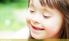Sindrome de nacimiento o genéticas