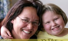 Sindrome de Prader-Willi