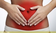 Sindrome de Crohn
