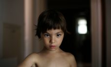 Sindrome de 5p-