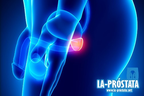 Prostatitis aguda: Causas, síntomas, diagnóstico y tratamiento