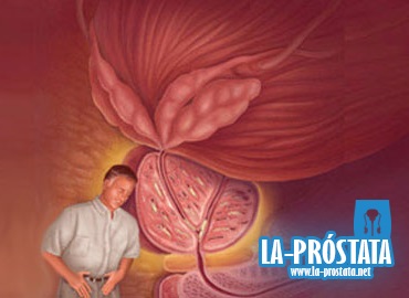 Prostatitis crónica, causas y sintomas