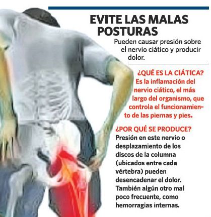 Por qué se inflama el nervio ciático