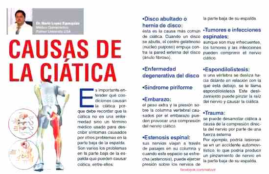 Por qué se produce la ciática