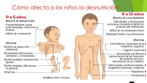 ¿A quiénes afecta la desnutrición?