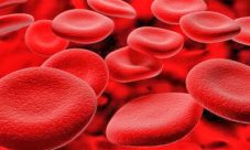 ¿Se convierte una anemia en leucemia?