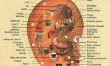 ¿Qué es la Auriculoterapia?