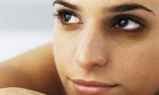 Remedios caseros para eliminar las ojeras