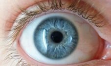 El glaucoma: La amenaza de perder la vista