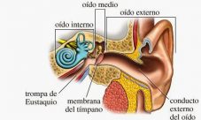 Infecciones del oído medio