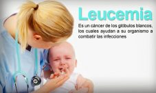 Leucemia: Causas, síntomas y tratamiento.