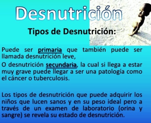 Tipos de desnutrición