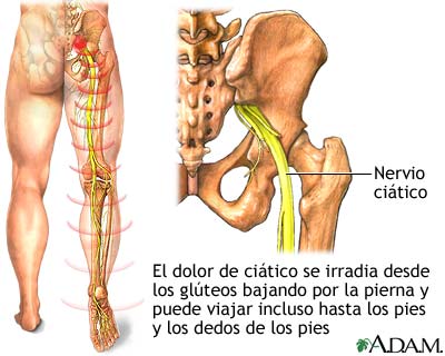 ¿Qué órganos afecta el nervio ciático?