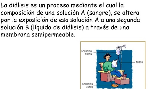 ¿Qué es una diálisis?