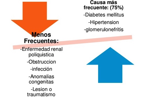 Enfermedades que causan insuficiencia renal